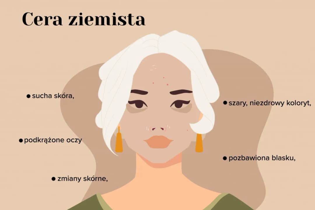 Ziemista cera: jak wygląda i jakie są jej cechy? Poznaj objawy